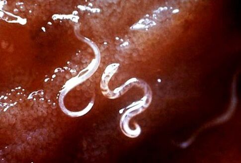 pasożyty w organizmie