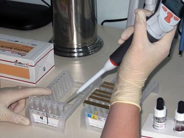Badania laboratoryjne w diagnostyce chorób pasożytniczych